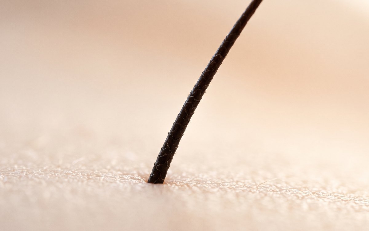 Macro d’un poil foncé émergeant d’une peau claire